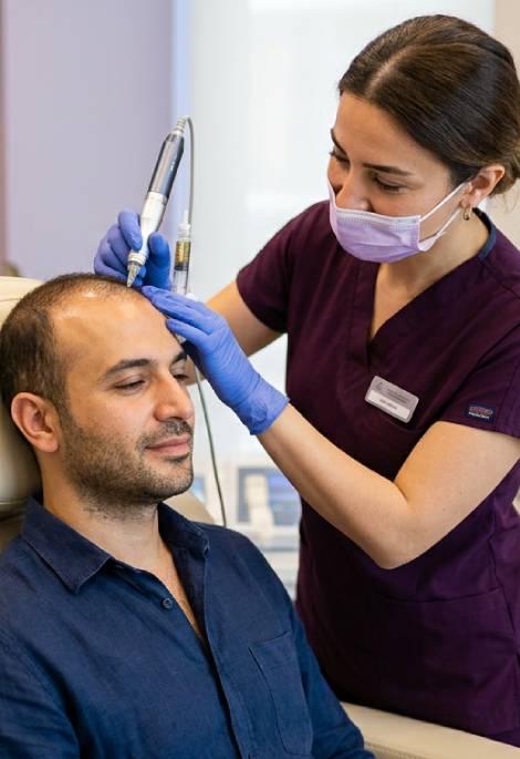 صورة ترويجية لخدمة الميزوثيرابي للشعر في مركز يور هير سنتر في تركيا