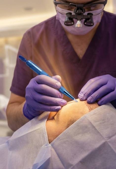صورة ترويجية لخدمة زراعة الشعر بتقنية قلم السفير في مركز يور هير سنتر
