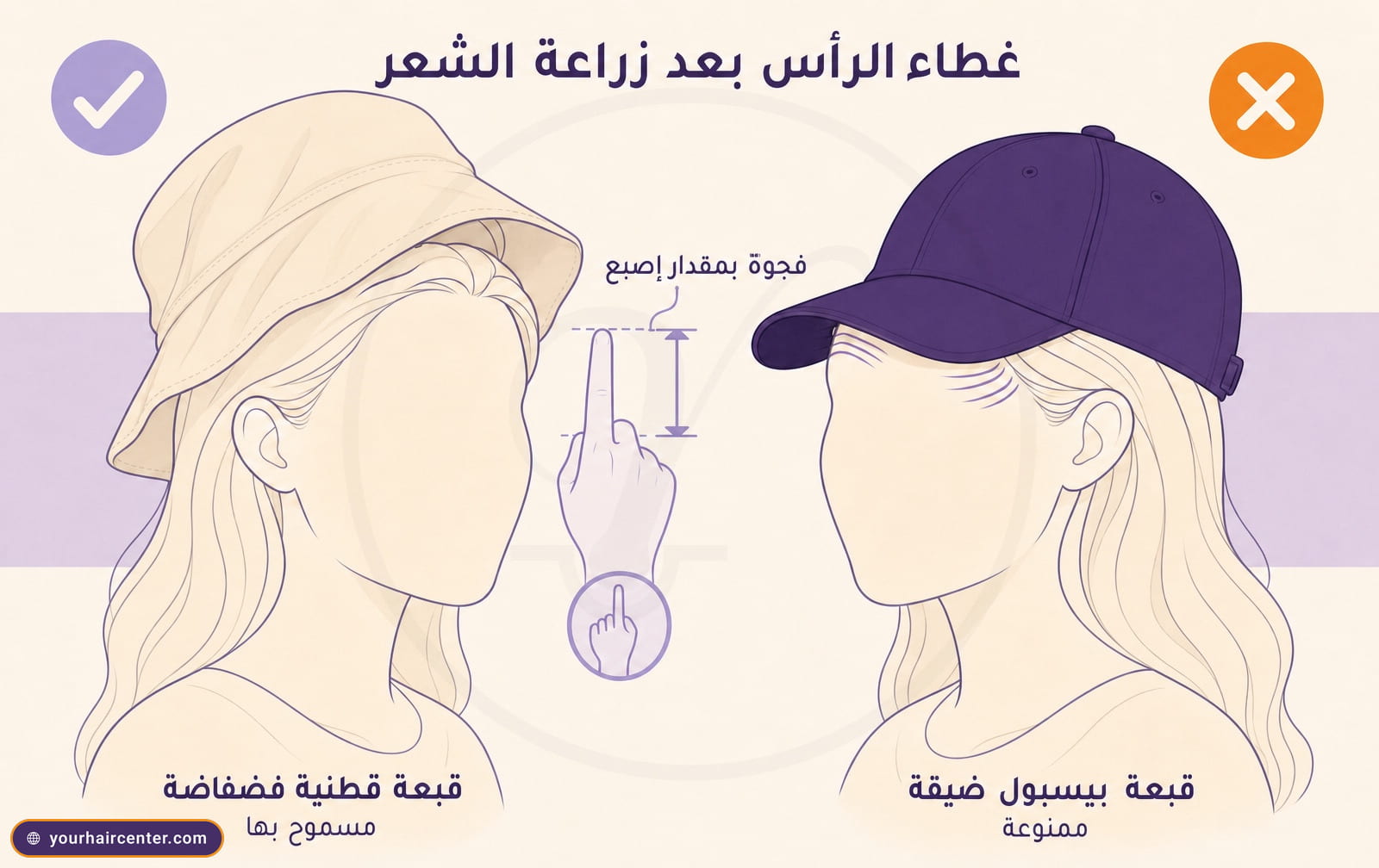 رسم تحريري يقارن قبعة قطنية فضفاضة مسموح بها وقبعة بيسبول ضيقة ممنوعة مع إيضاح فجوة الإصبع بين القماش وفروة الرأس
