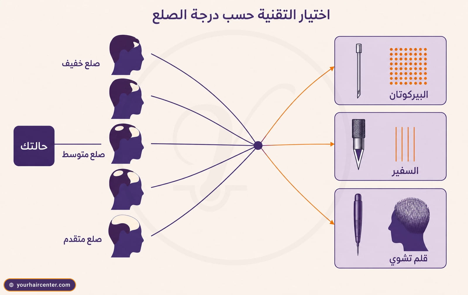 إنفوغرافيك شجرة قرار يربط بين ست صور لأنماط الصلع الخفيف والمتوسط والمتقدم والتقنيات الثلاث، البيركوتان والسفير وقلم تشوي