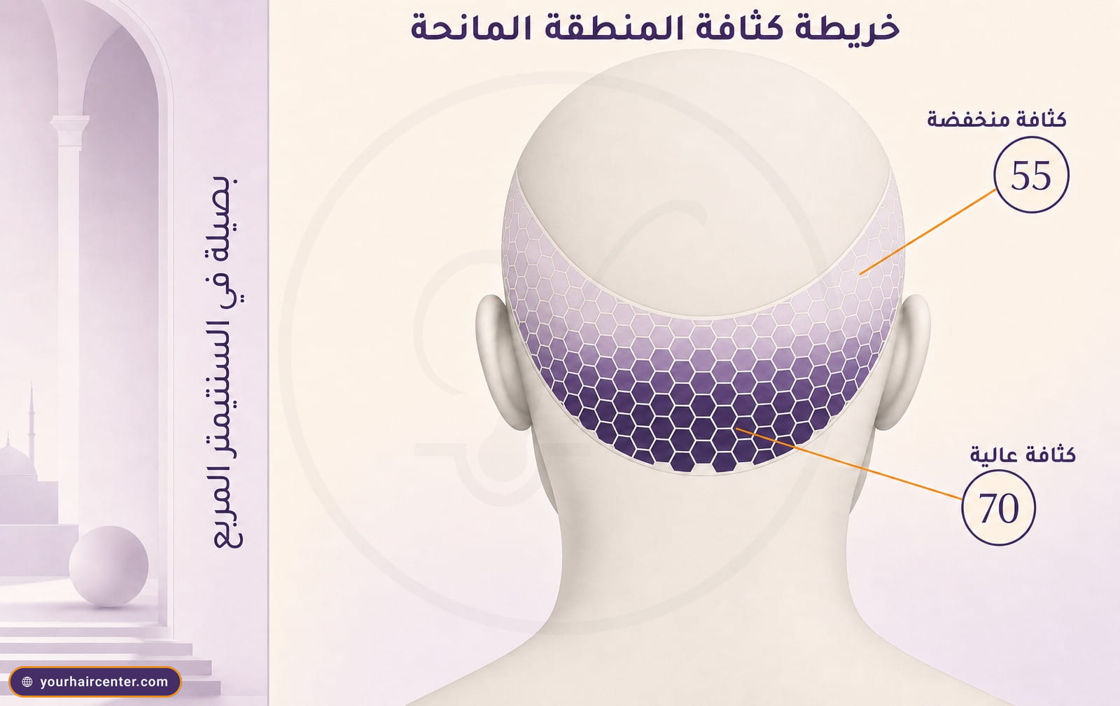 خريطة كثافة للمنطقة المانحة على مؤخرة الرأس مقسمة إلى مربعات سداسية، منطقة عالية الكثافة 70 ومنطقة منخفضة الكثافة 55 بصيلة لكل سنتيمتر مربع