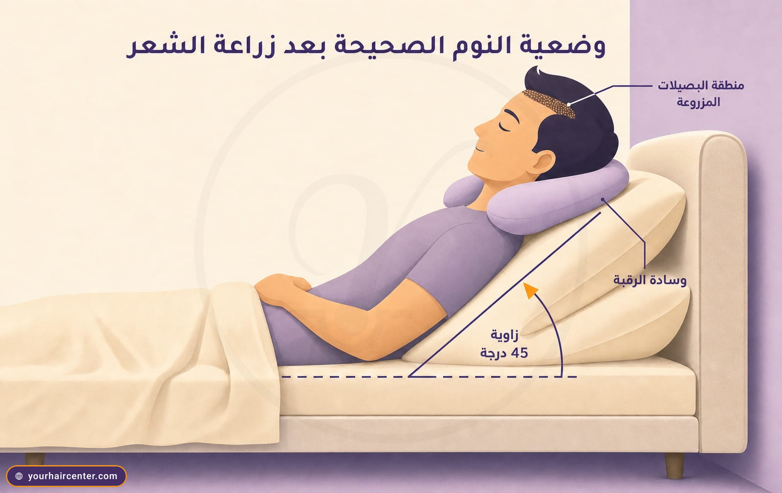 رسم توضيحي لرجل نائم بزاوية 45 درجة على وسادة رقبة بنفسجية مع شريط ذهبي يحدد منطقة البصيلات المزروعة في مقدمة الرأس