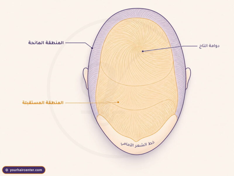 رسم تشريحي علوي لفروة رأس ذكورية بمنطقة مستقبلة ذهبية ومنطقة مانحة بنفسجية ودوامة تاج مركزية
