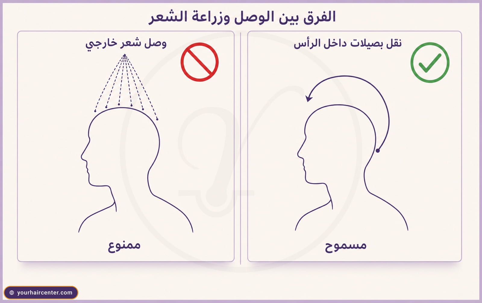 رسم خطي يقابل بين وصل شعر خارجي بخطوط متقطعة وعلامة منع حمراء وبين نقل بصيلات داخل نفس الرأس بسهم منحنٍ وعلامة صح خضراء