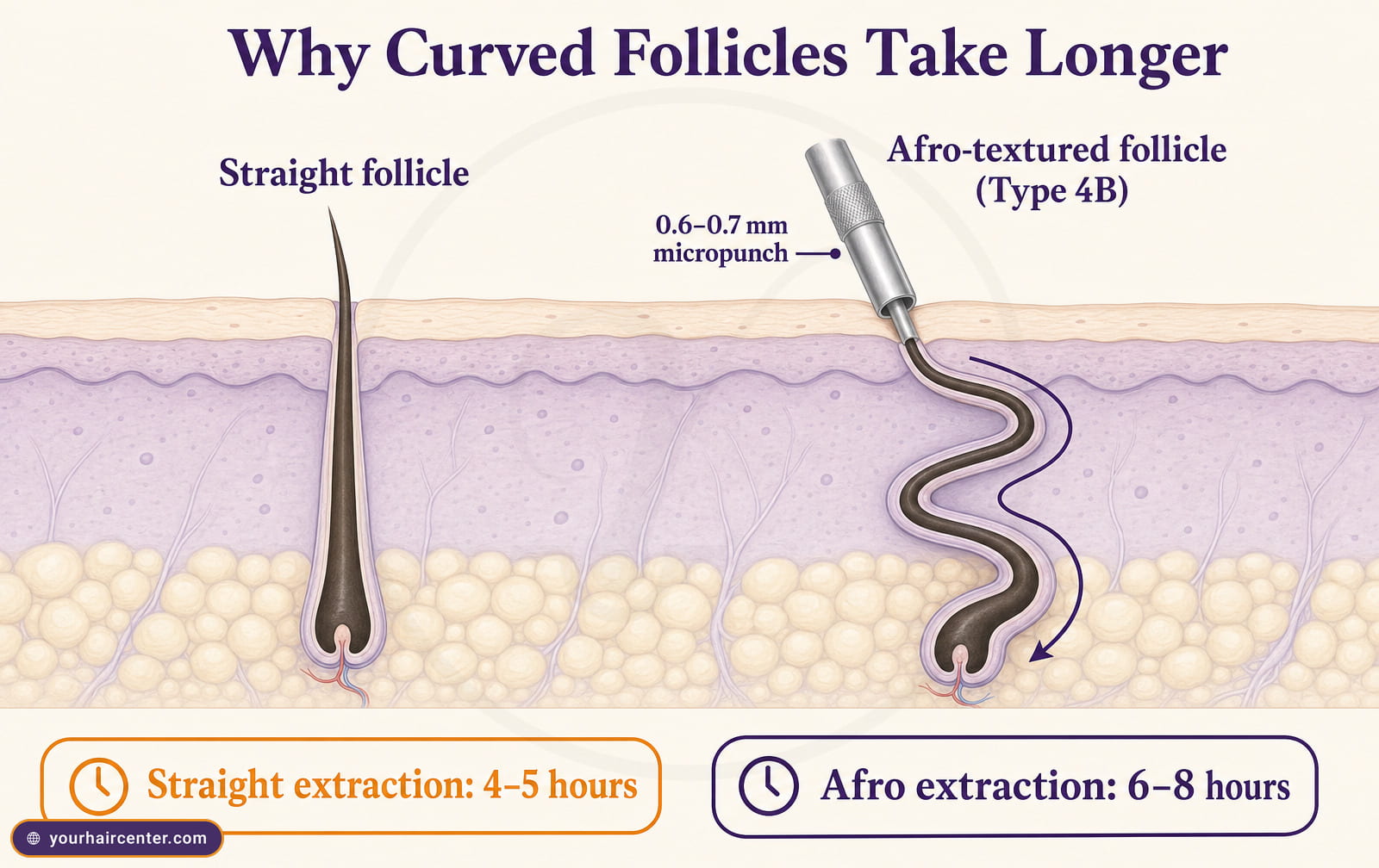 Cross-section contrasting a straight follicle with a curved afro follicle and the 0.6 to 0.7 mm micropunch entry angle