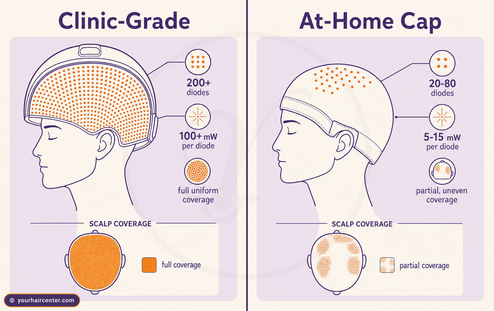 Clinic-grade laser with 200-plus diodes and full scalp coverage versus a partial-coverage at-home cap with 20-80 diodes