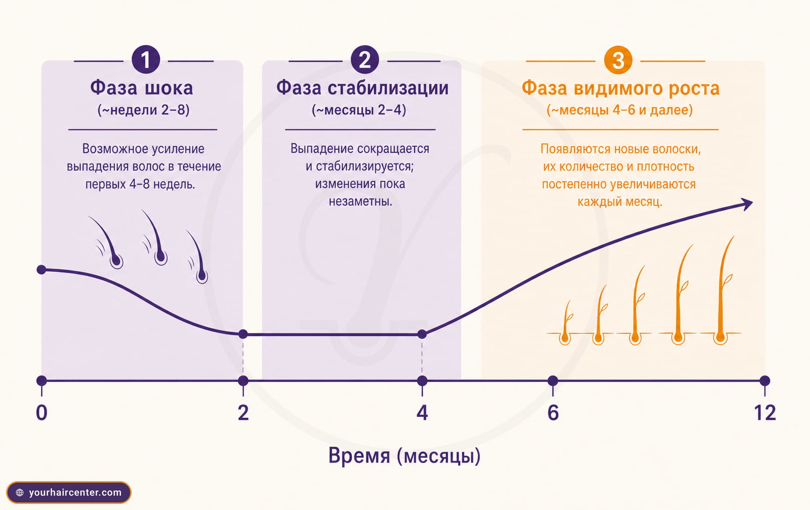 Инфографика трёх фаз ответа на миноксидил для волос с временной шкалой от 0 до 12 месяцев