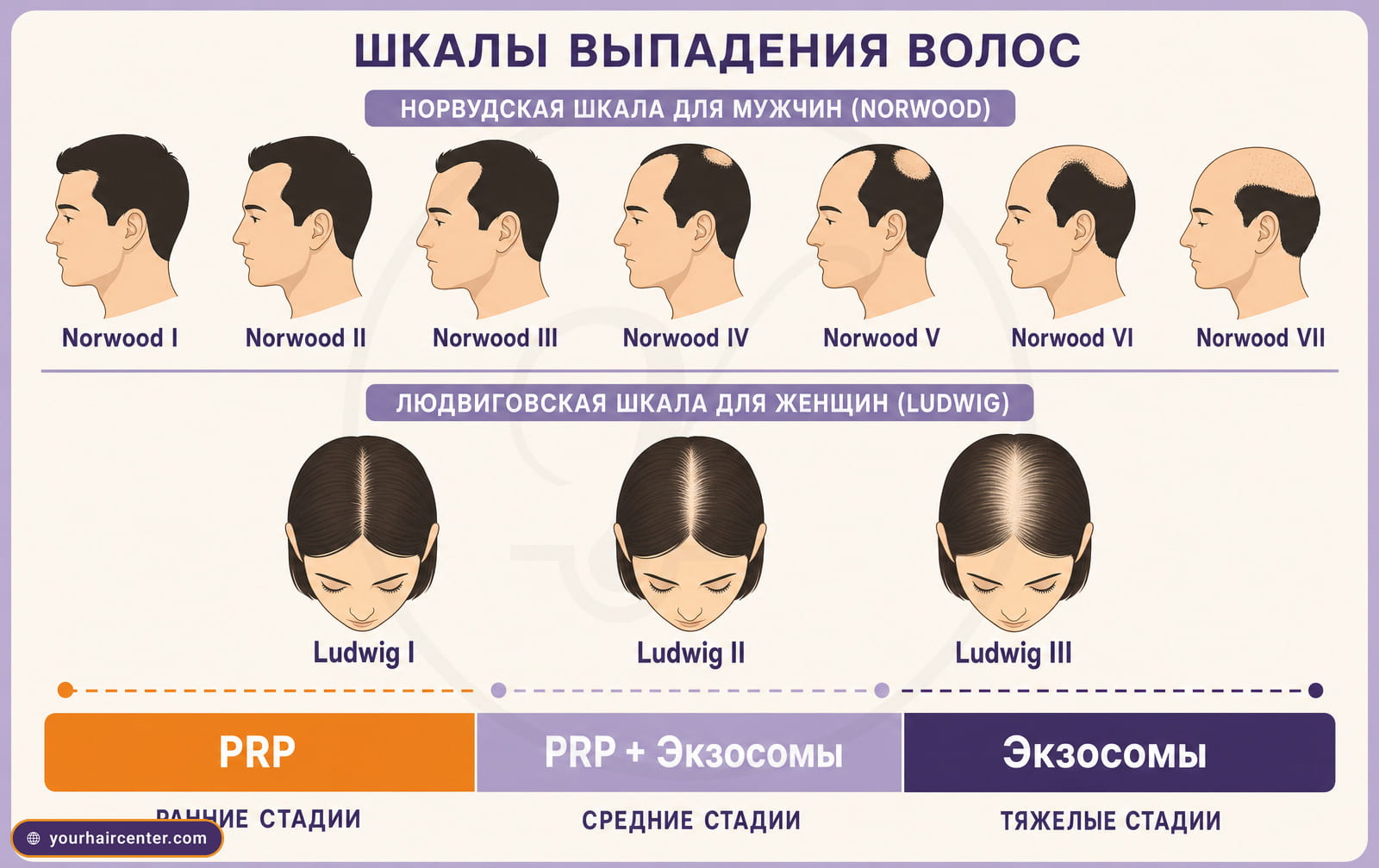 Инфографика стадий выпадения, шкала Норвуда для мужчин и Людвига для женщин с цветовыми зонами PRP, комбинации и экзосом