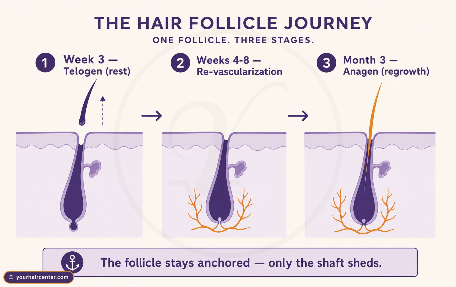 Diagram of shock-loss hair cycle showing telogen rest, follicle re-vascularization, and anagen regrowth after eyebrow transplant
