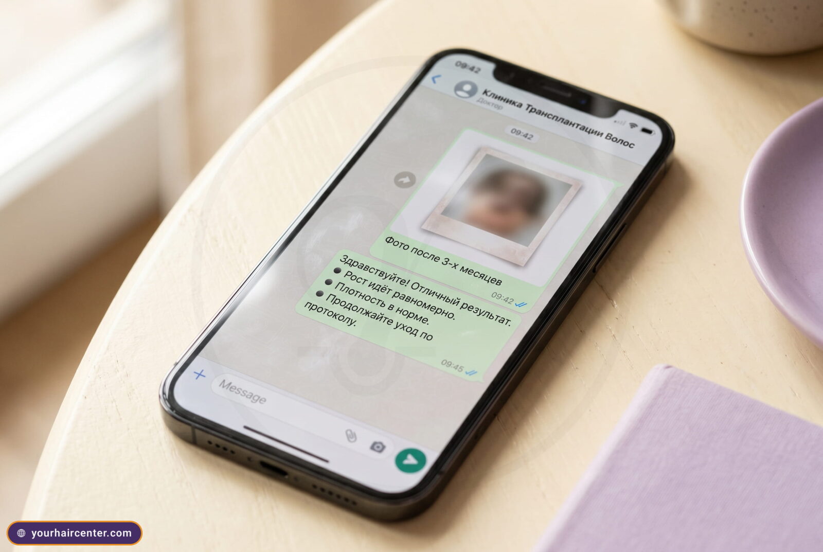 Смартфон на светлом столе с открытым WhatsApp-чатом, врач разбирает фото восстановления после пересадки волос