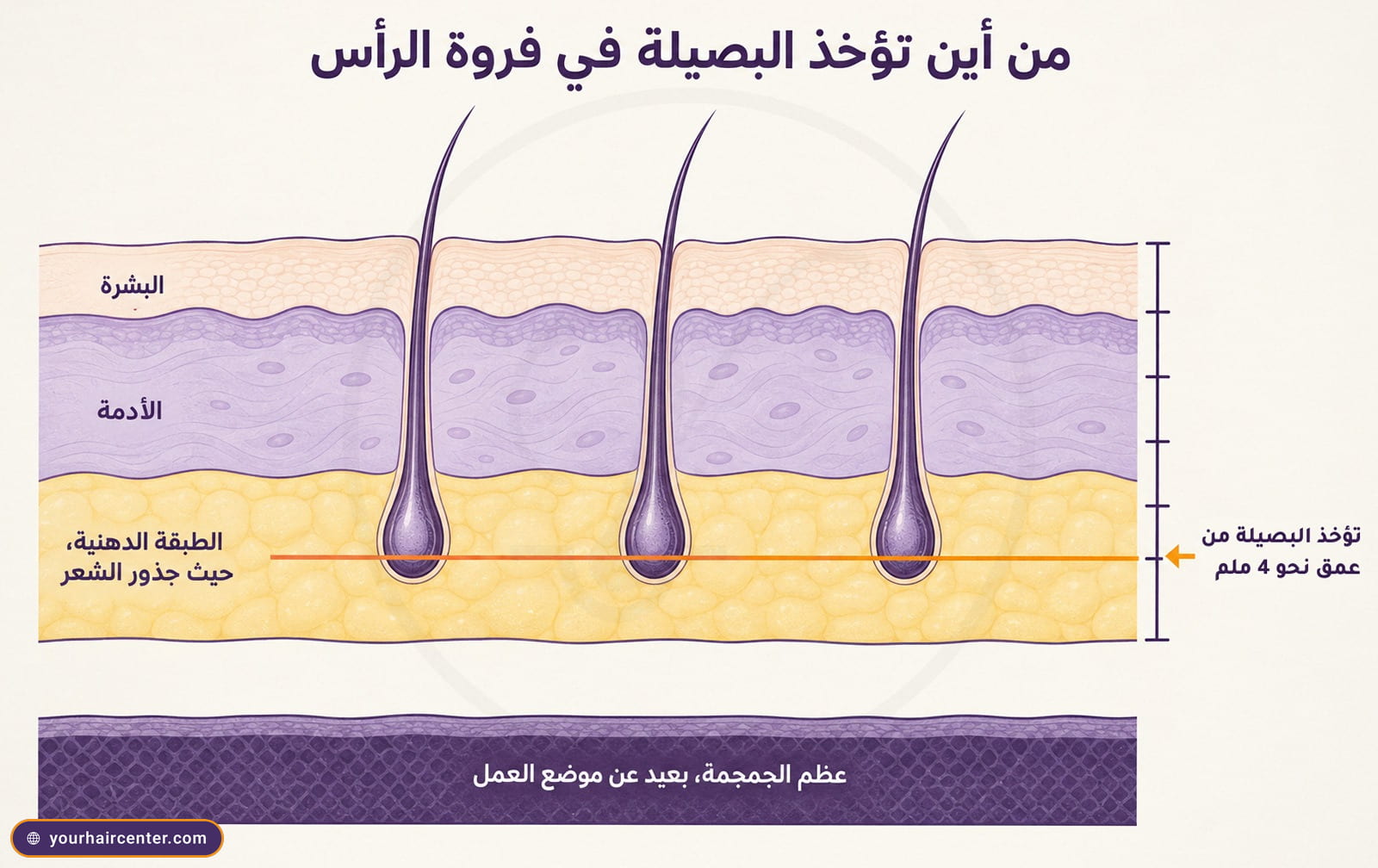 مقطع تشريحي مبسط لفروة الرأس يوضح أن البصيلة تؤخذ من عمق نحو 4 ملم في الطبقة الدهنية تحت الجلد بعيداً عن عظم الجمجمة